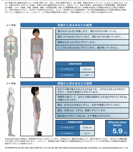 Posture Analysis 姿勢写真分析　単発メニュー