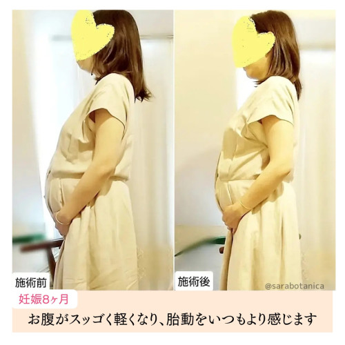 胎動 赤ちゃんがお腹の下の方で動いて不安です