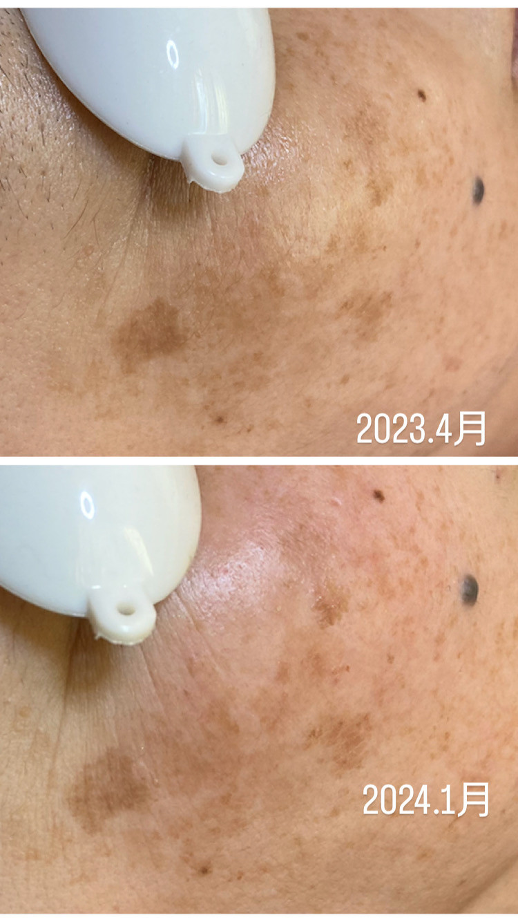 毎日ご自宅でのケアも大切です