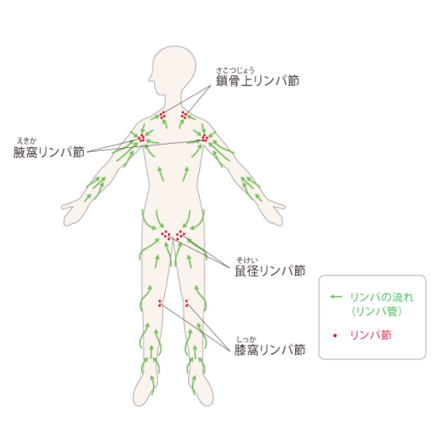 lymphedema01.png