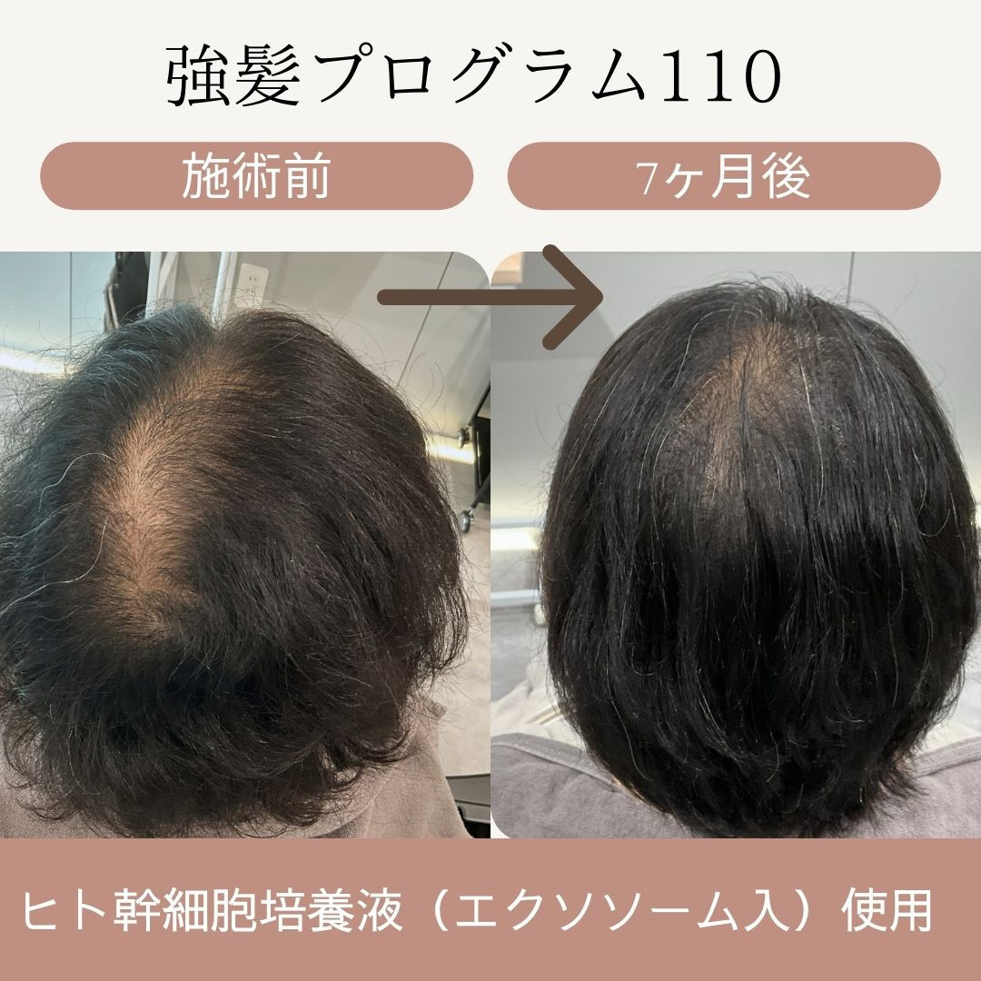 薄毛のお悩みご相談ください
