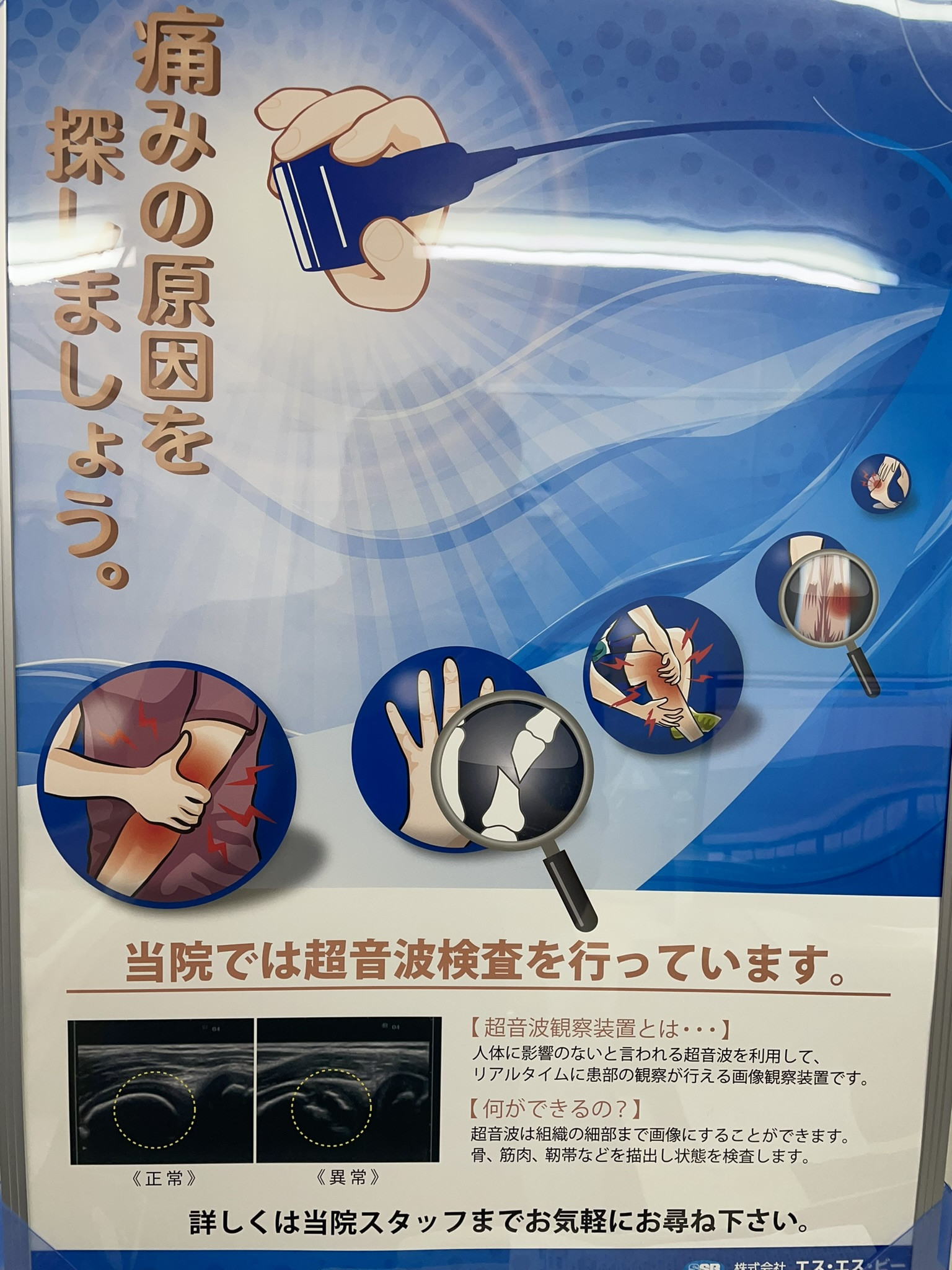 エコー超音波観察装置