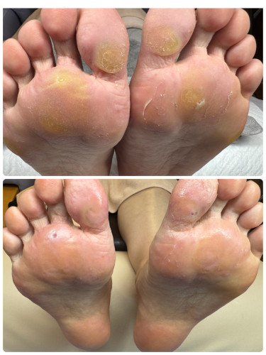 タコとおさらば