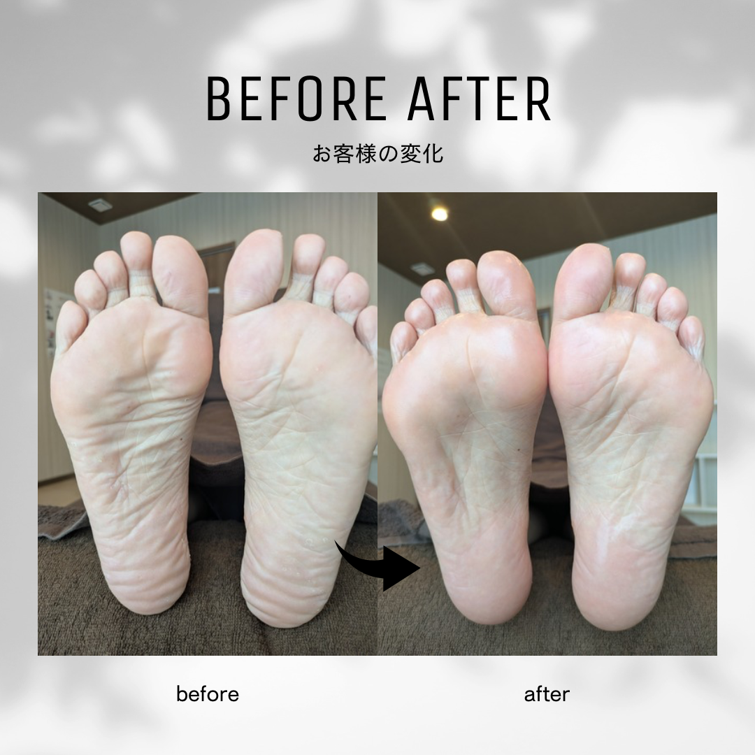 白黒　シンプル　ビフォーアフター　インスタグラムの投稿　正方形 - 1.png