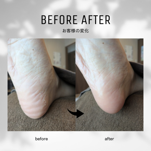 白黒　シンプル　ビフォーアフター　インスタグラムの投稿　正方形 - 2.png