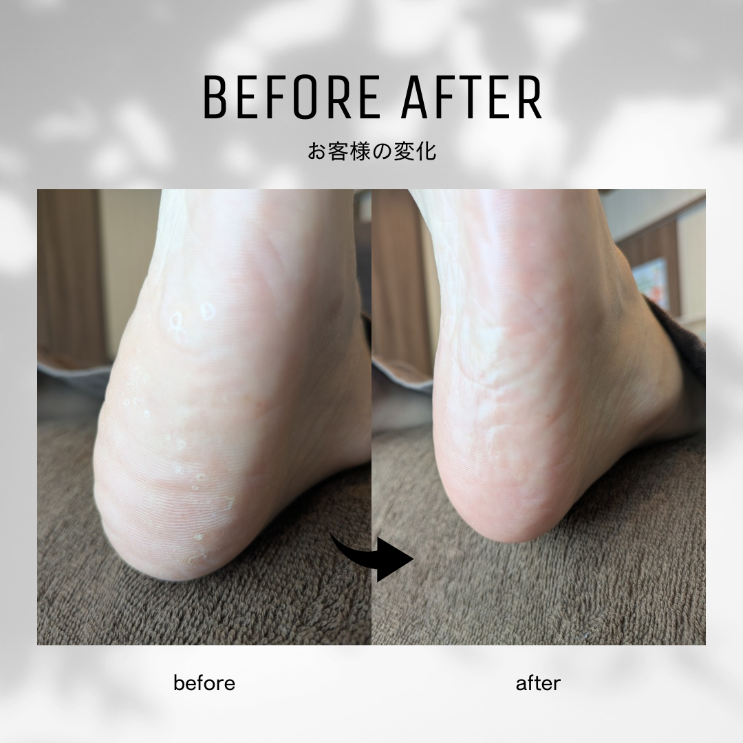 白黒　シンプル　ビフォーアフター　インスタグラムの投稿　正方形 - 3.png