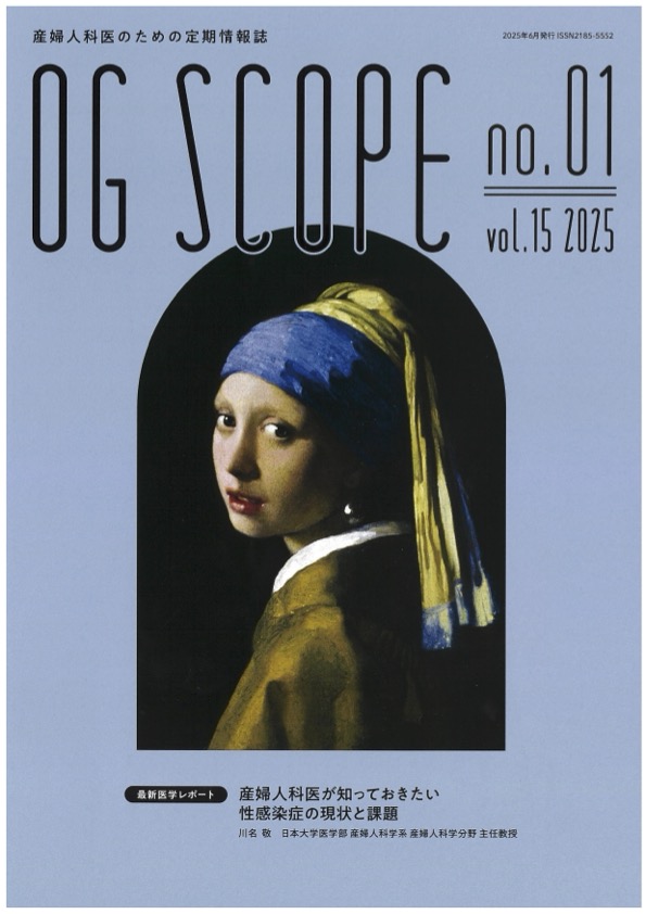 OG SCOPEにて中島俊（PI）の第4回連載が掲載
