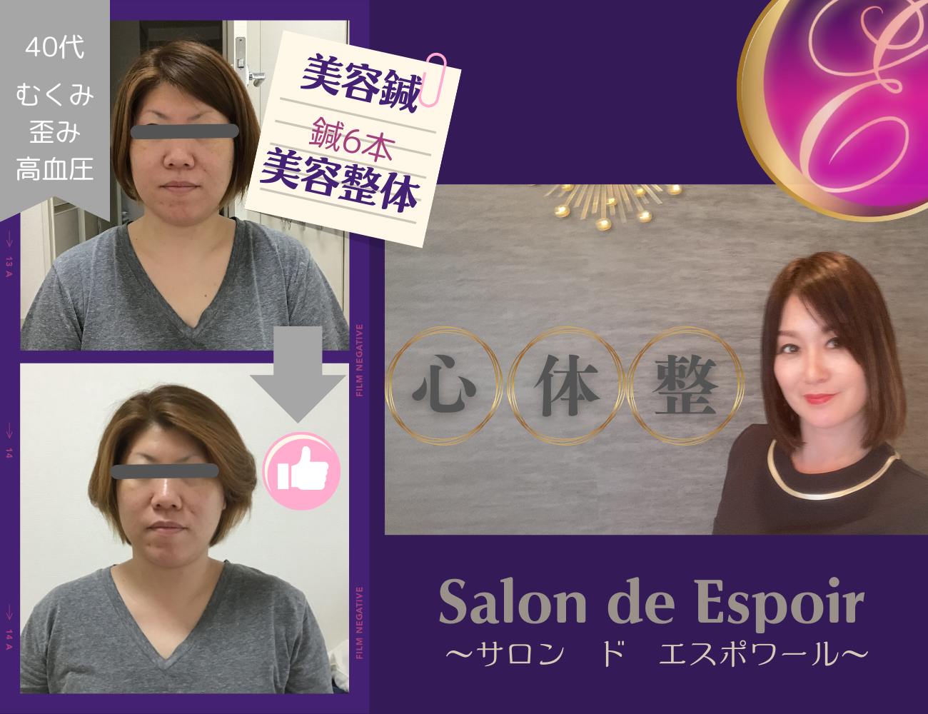美容鍼灸　Salon de Espoir