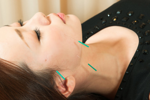 photo_beautyacupuncture_about_noelectricity.jpg