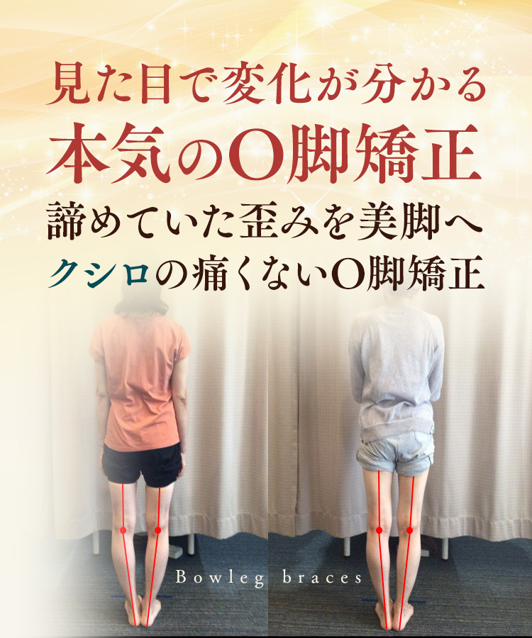 見た目で変化が分かる！諦めていた歪みをまっすぐ美脚へ！クシロの「痛くない」本気のO脚矯正