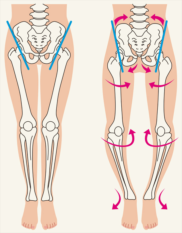 骨盤の傾き具合と脚のねじれ