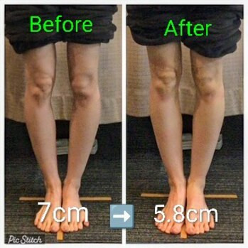 O脚モニター募集中！今だけお試し価格で美脚への第一歩を
