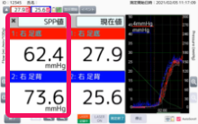 SPP.png
