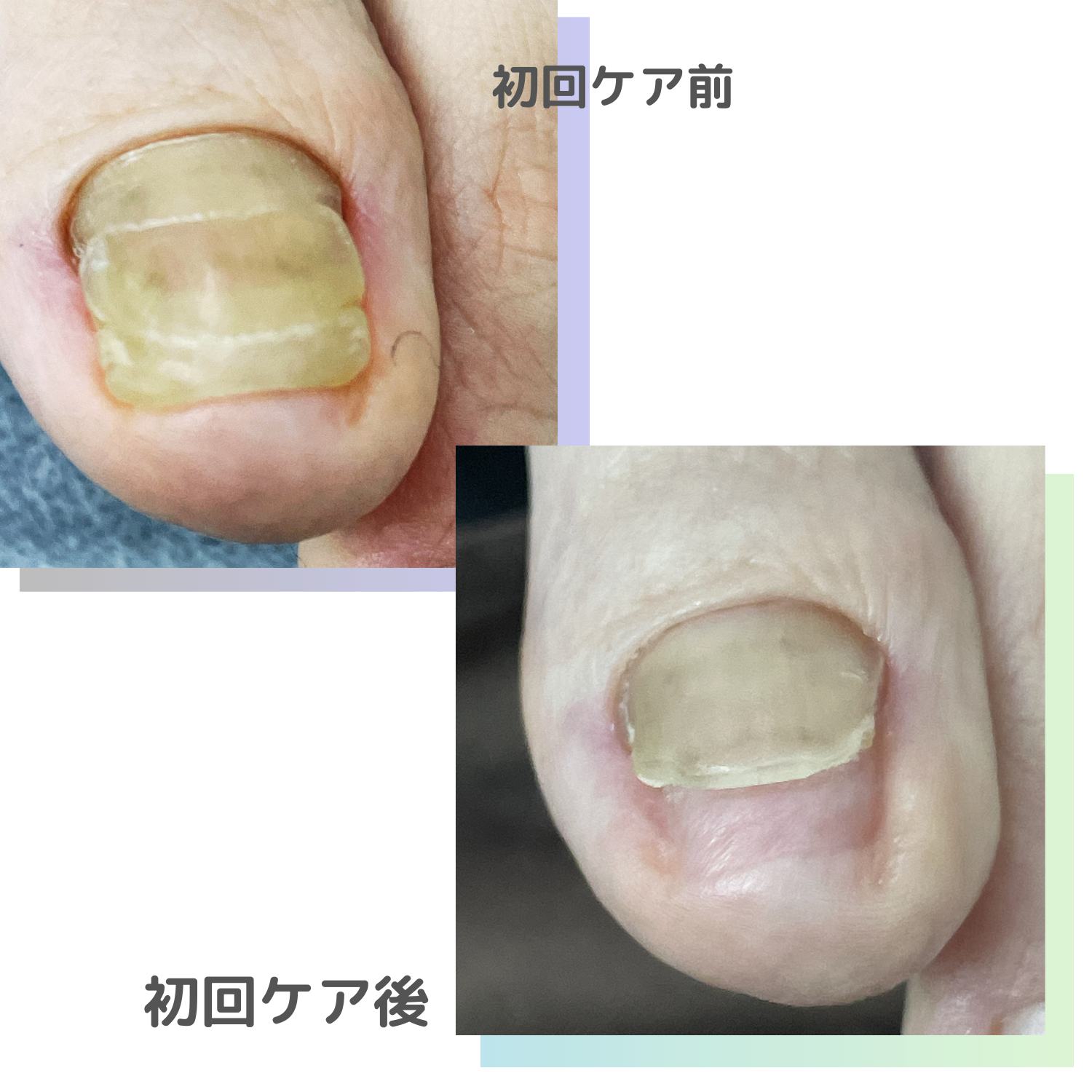 リスタートケア Before After