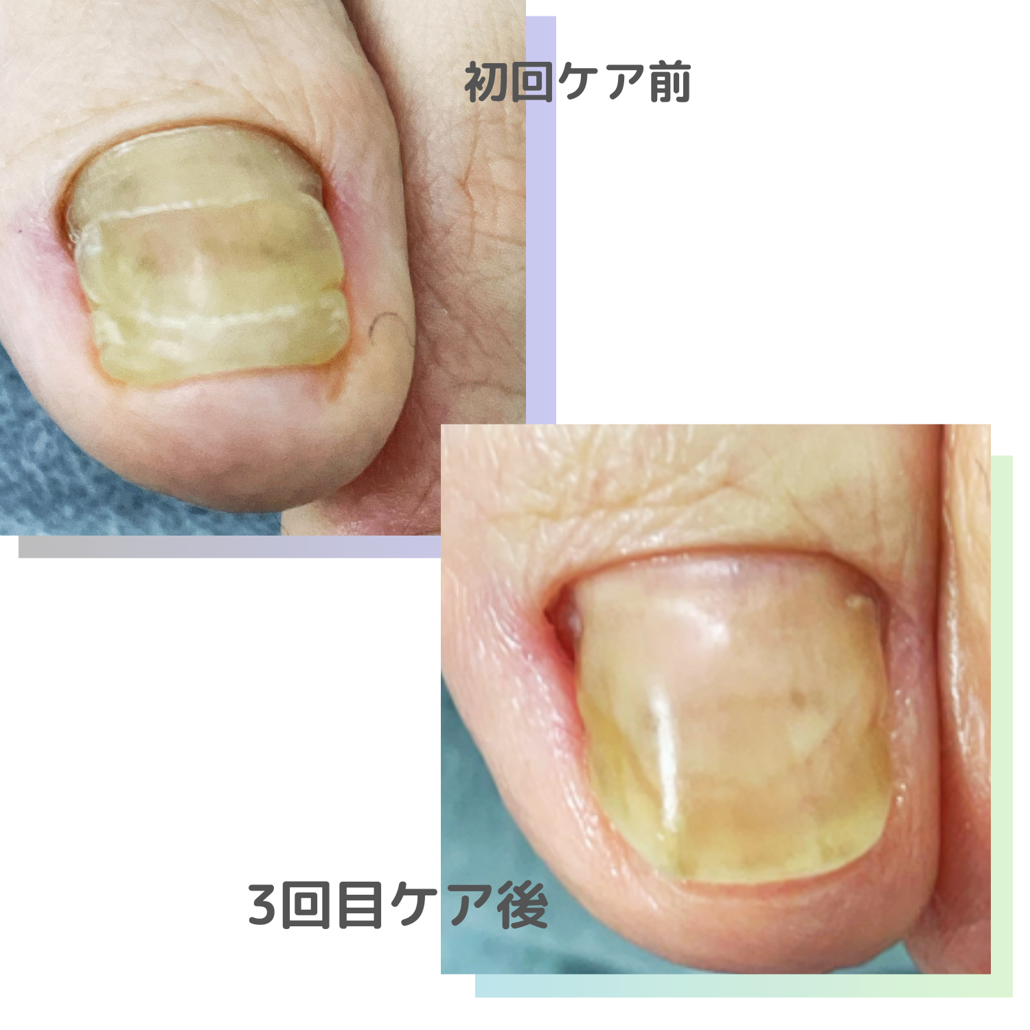 リスタートケア Before After