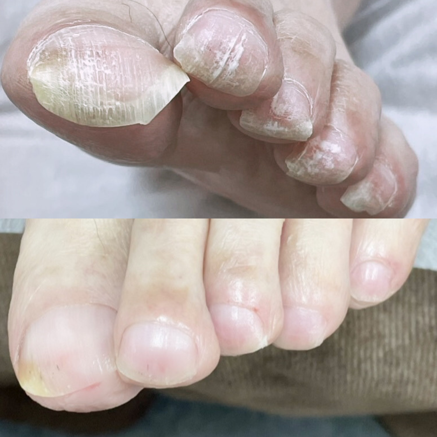 爪切り Before After