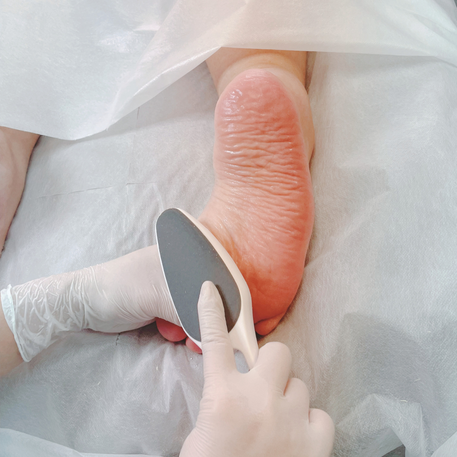 角質ケア