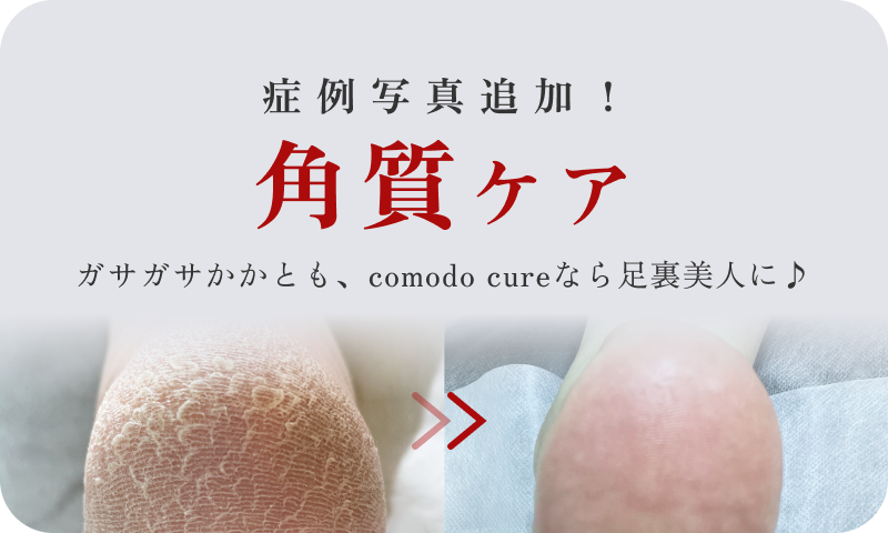 症例写真追加 角質ケア