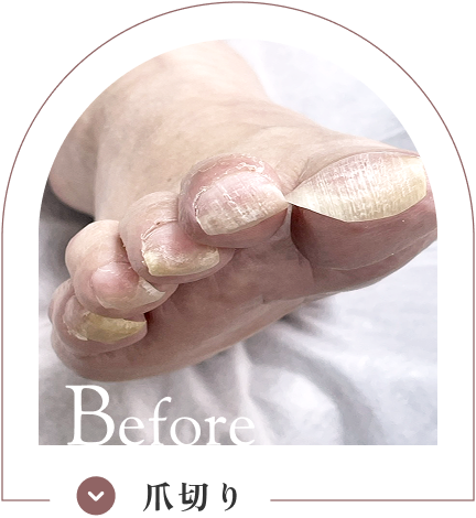 爪切り