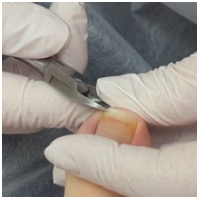 施術ブログ始めました