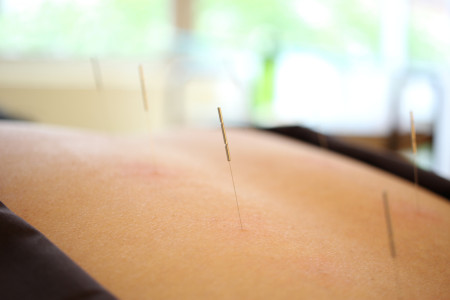 難病治療イメージ