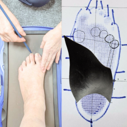 ３Ⅾ骨格インソールコース