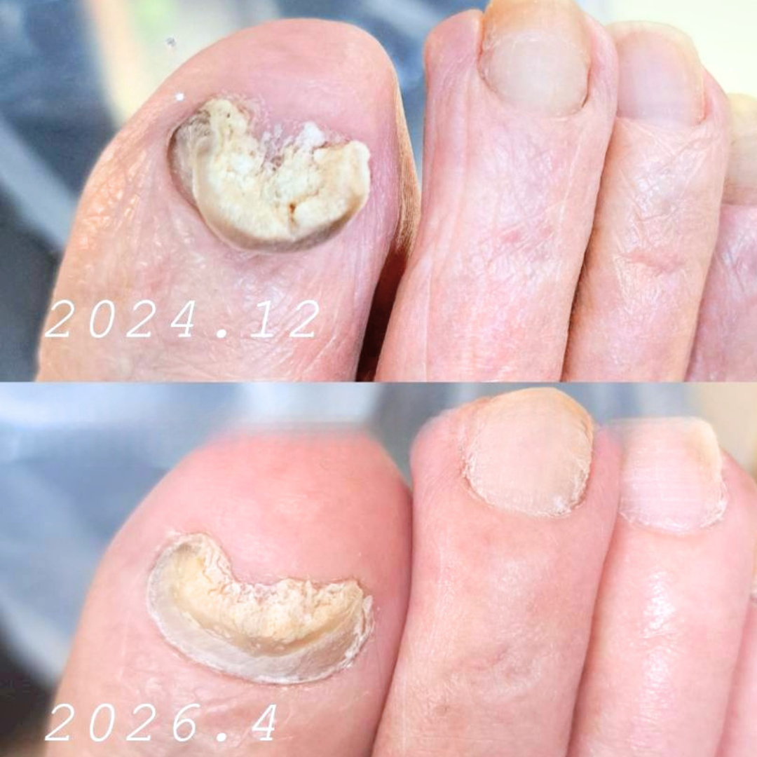 高齢者フットキュアリスト養成講座