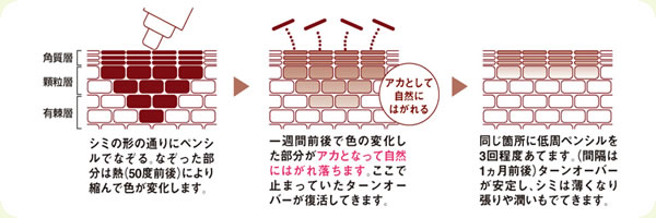 シミケア 30分当て放題