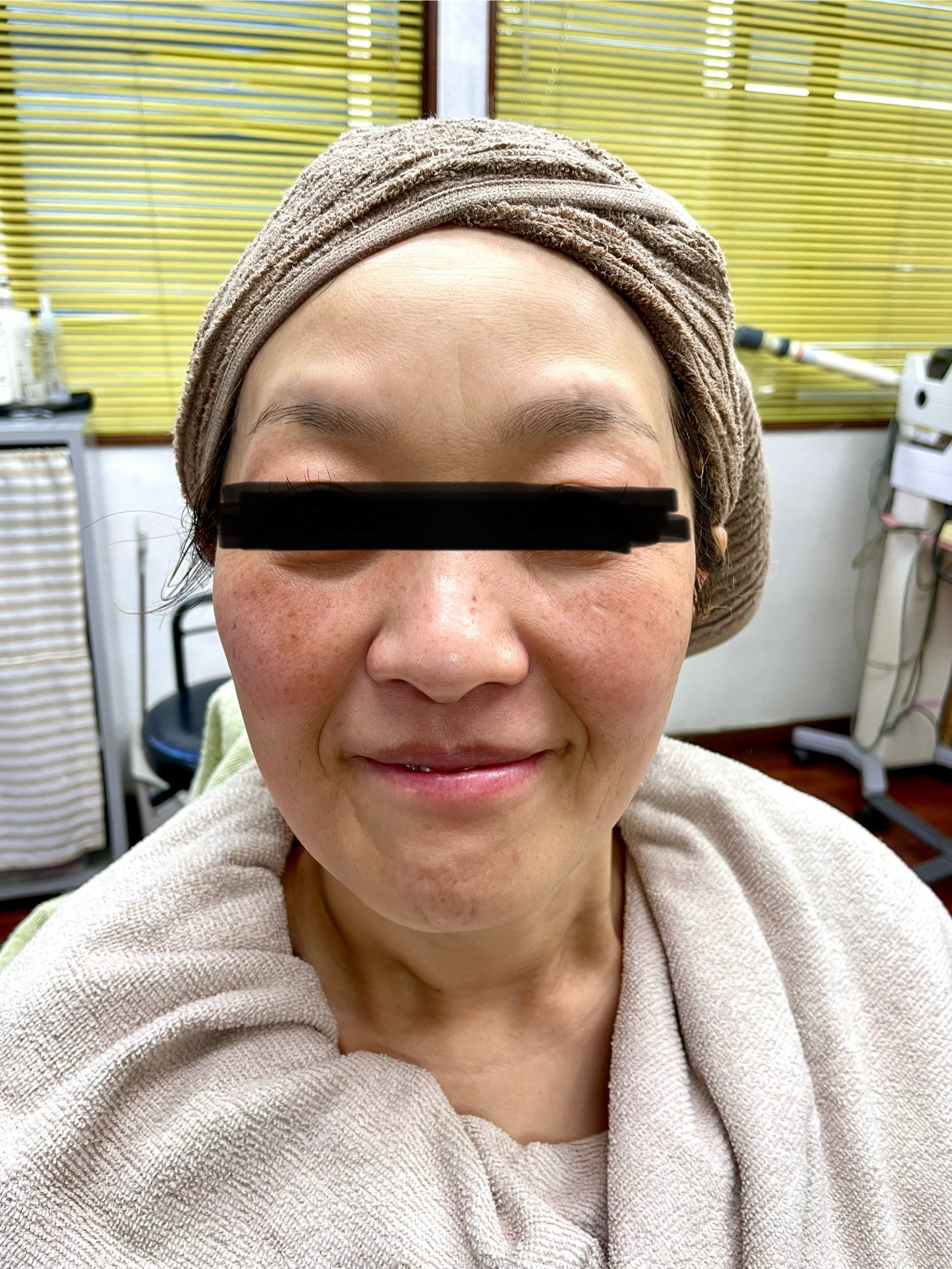 みかさんパック前.JPG