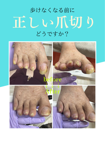 爪切りできていますか？