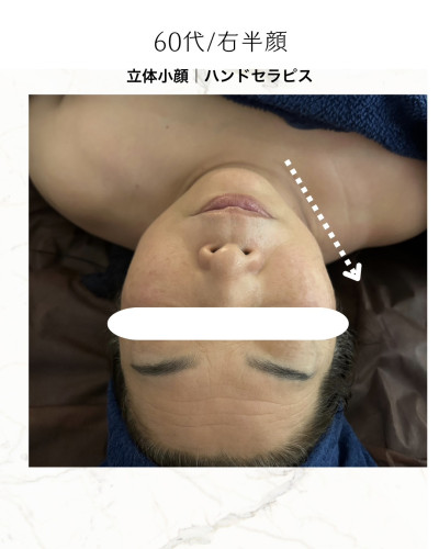白　オレンジ　シンプル　ビフォーアフター　Instagramの投稿　縦長.zip - 9.jpeg
