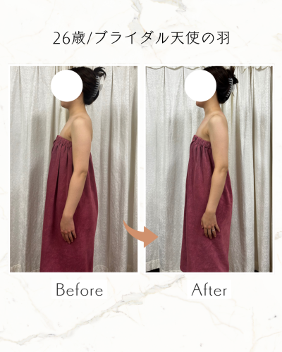 白　オレンジ　シンプル　ビフォーアフター　Instagramの投稿　縦長.zip - 5.png