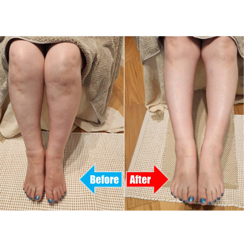 Before After.jpg