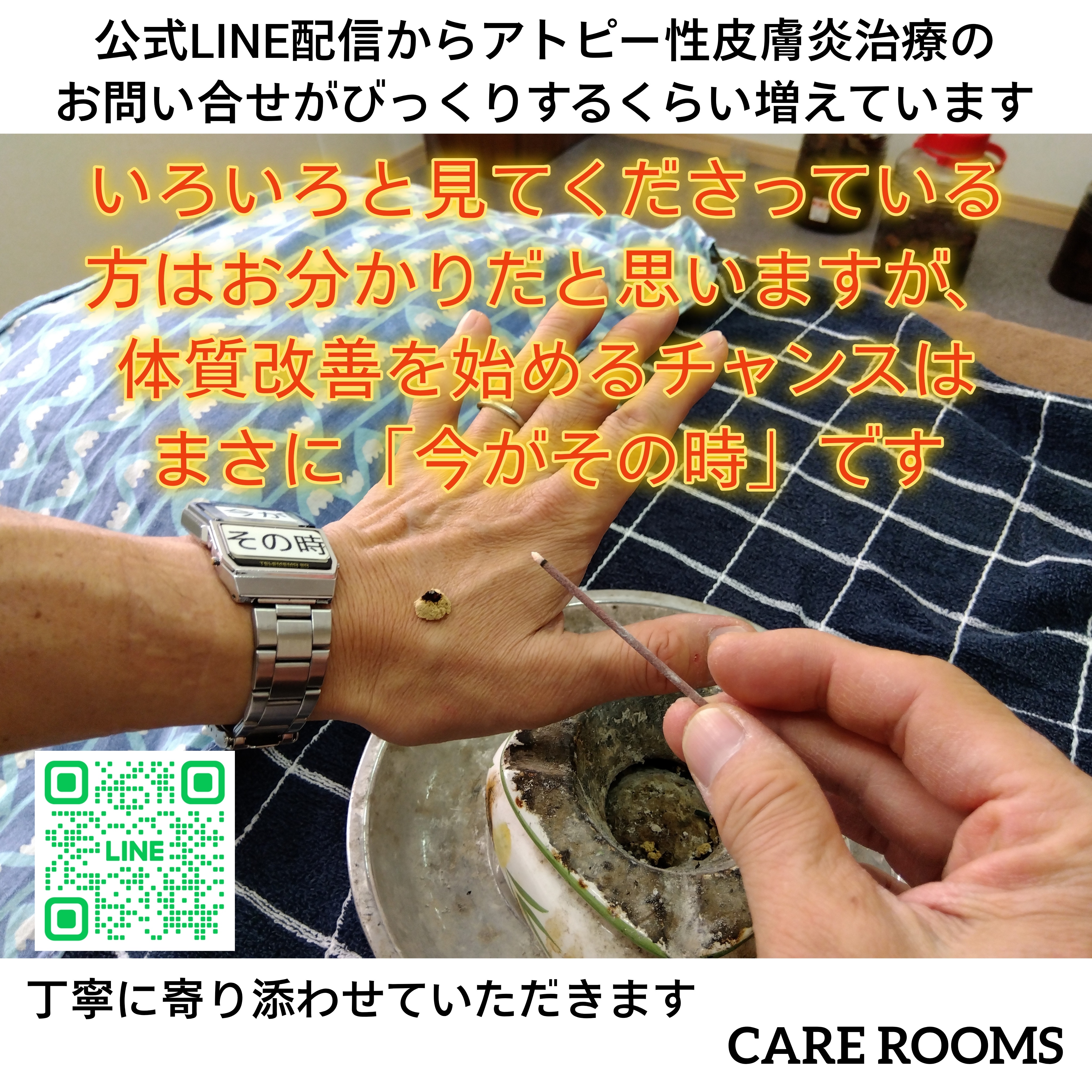 アトピー性皮膚炎治療について