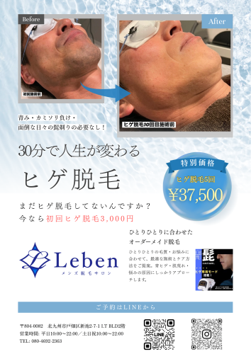ヒゲ脱毛5回37,500円‼️