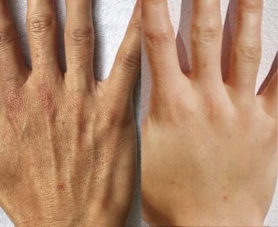 空気と水のエステ