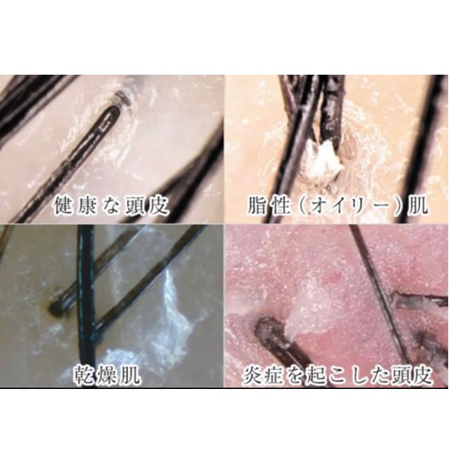 匂い，かゆみのもとから解消する天然水デトックスケア