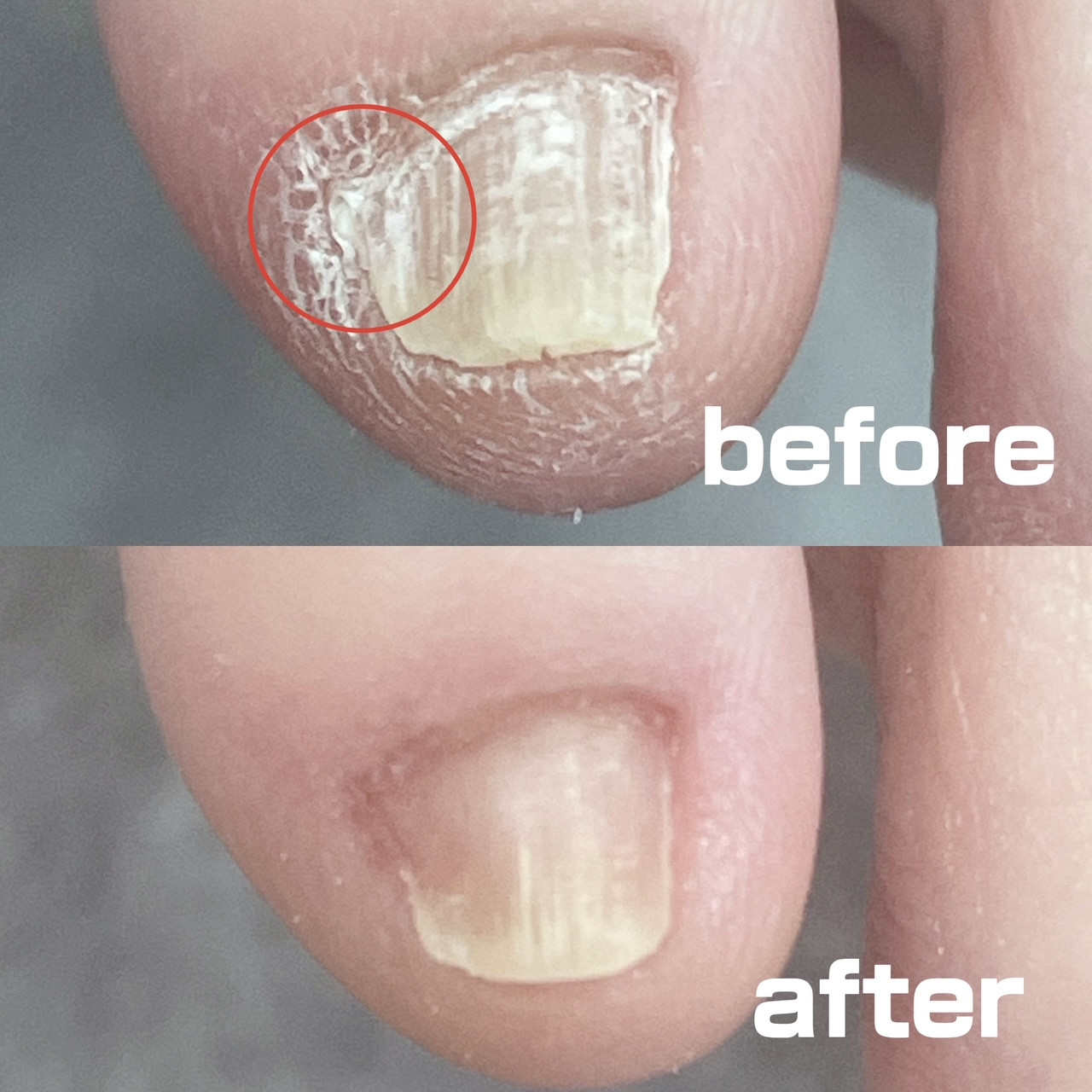 副爪ケア before after