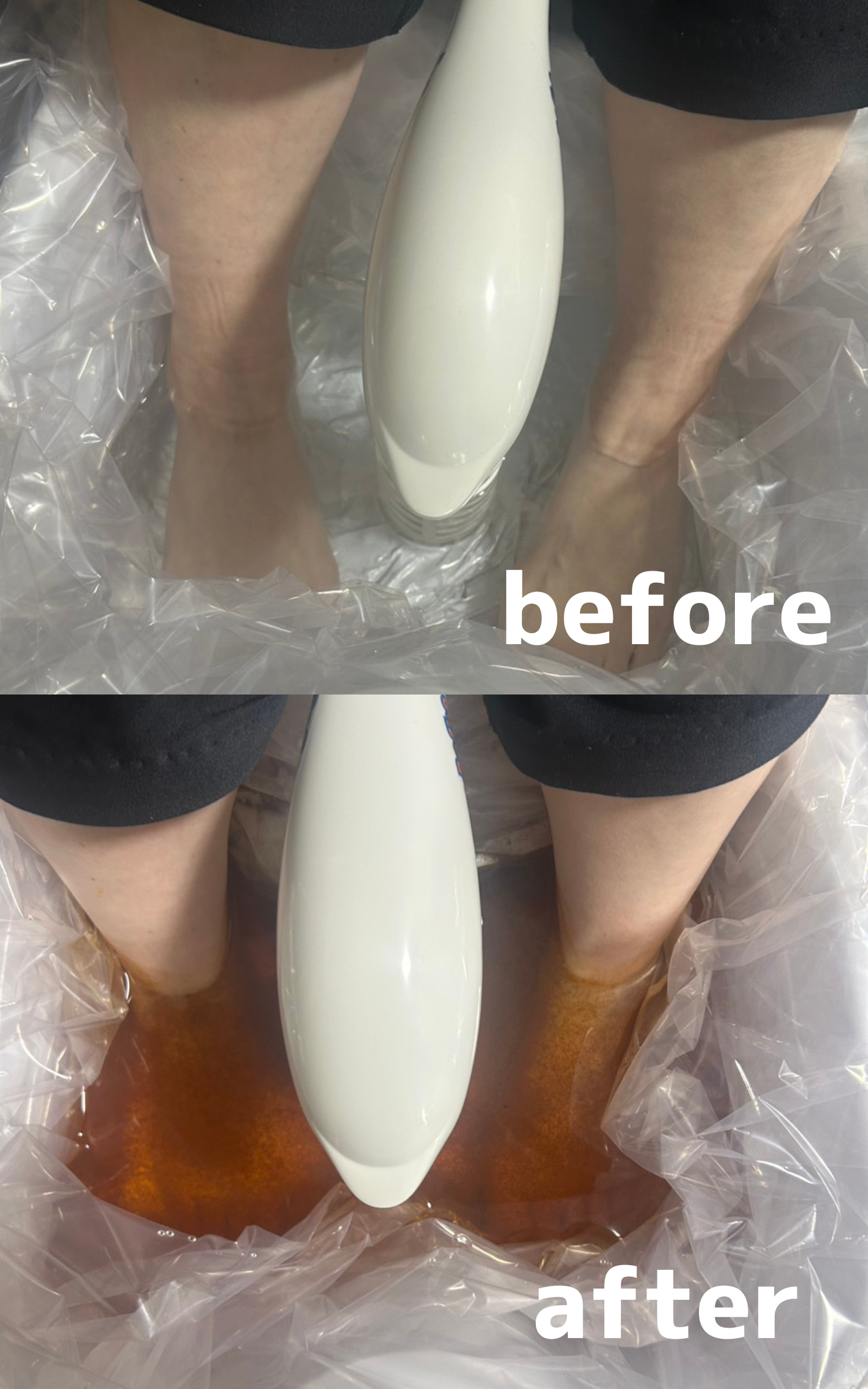 ゴッドクリーナーゴールド施術の様子