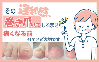 【4月のおすすめ】その違和感、巻き爪かもしれません。