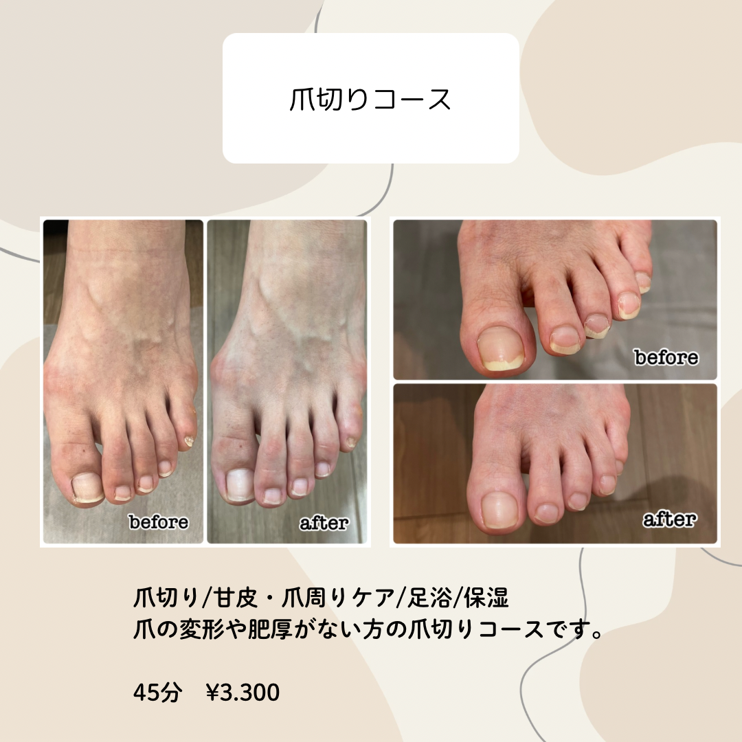 爪切りコース