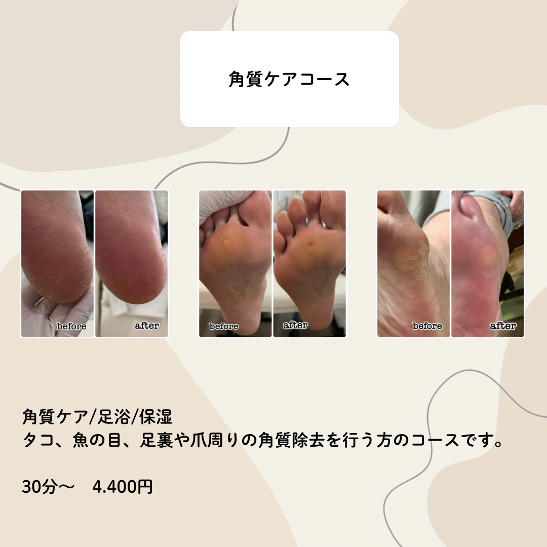 角質ケアコース