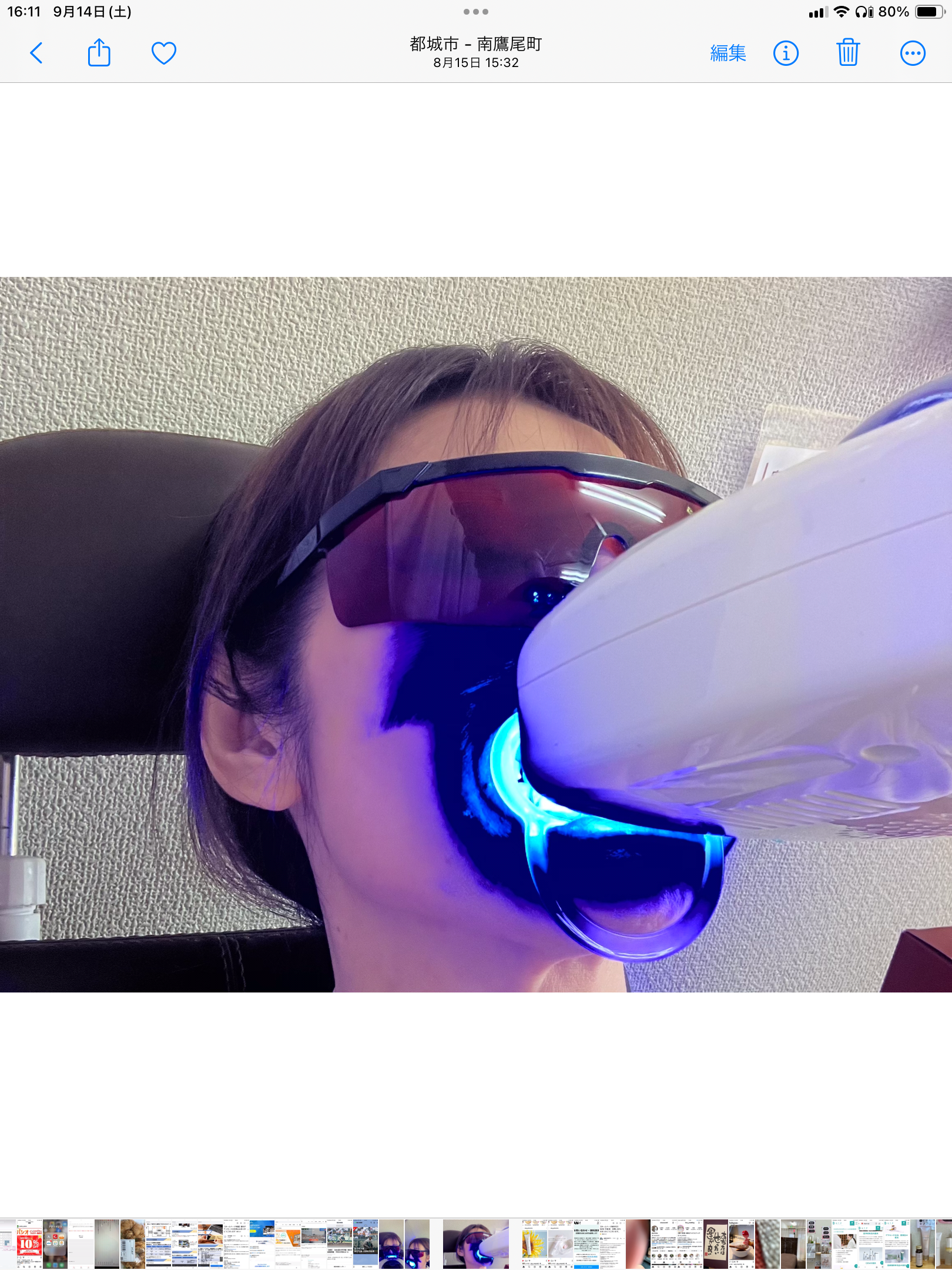 歯のホワイトニング