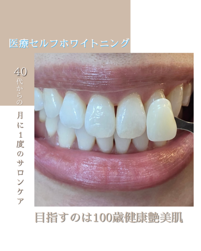 1000001588 (1).png