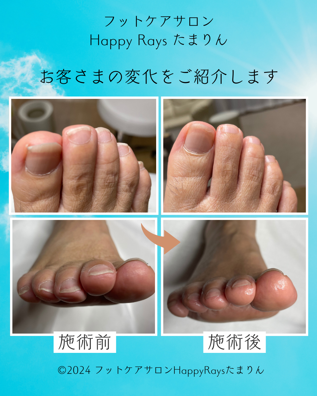 メニュー - 内子町街並みの古民家フットケアサロンHappyRaysたまりん