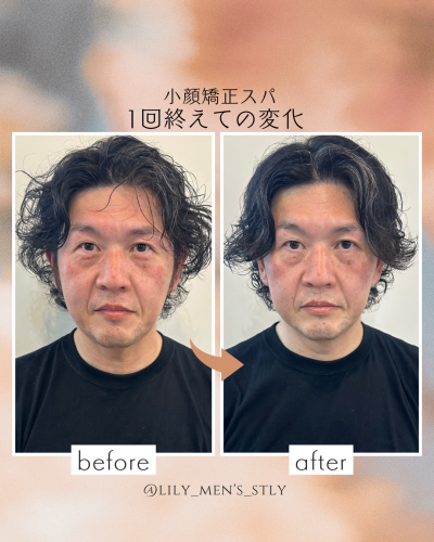 白　オレンジ　シンプル　ビフォーアフター　Instagramの投稿　縦長.png