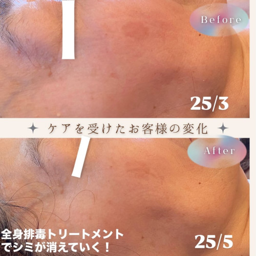 全身を整えると肌が変わる