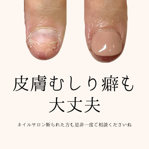 青 白 キャンペーン 美容 広告 インスタグラム投稿のコピーのコピー.zip - 2.jpeg
