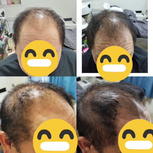 初回　8万発