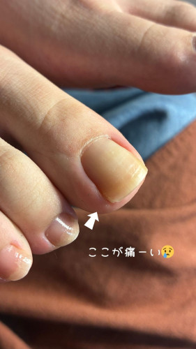 ここが痛ーい😢.jpg